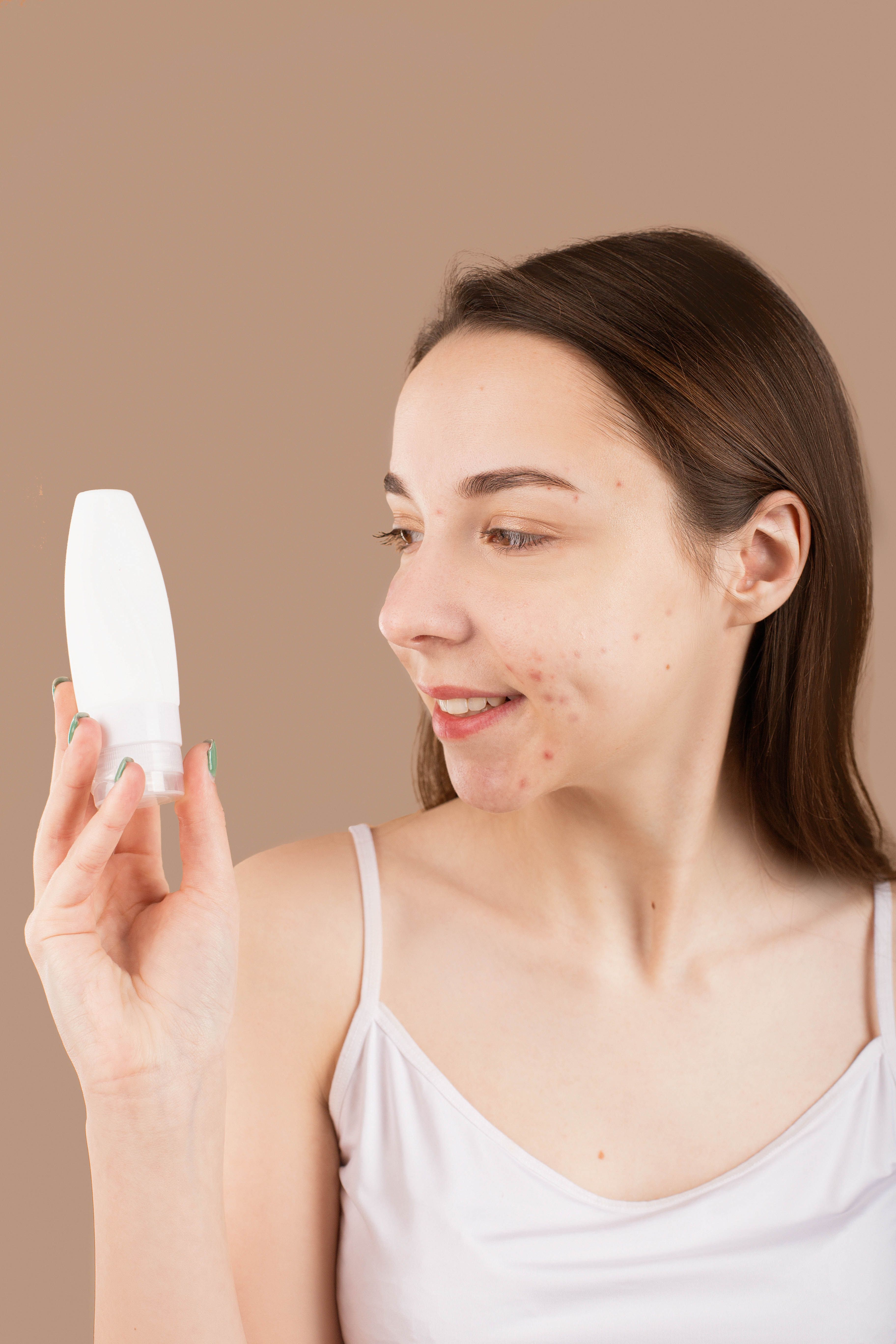 Reference photograph of facial acne
