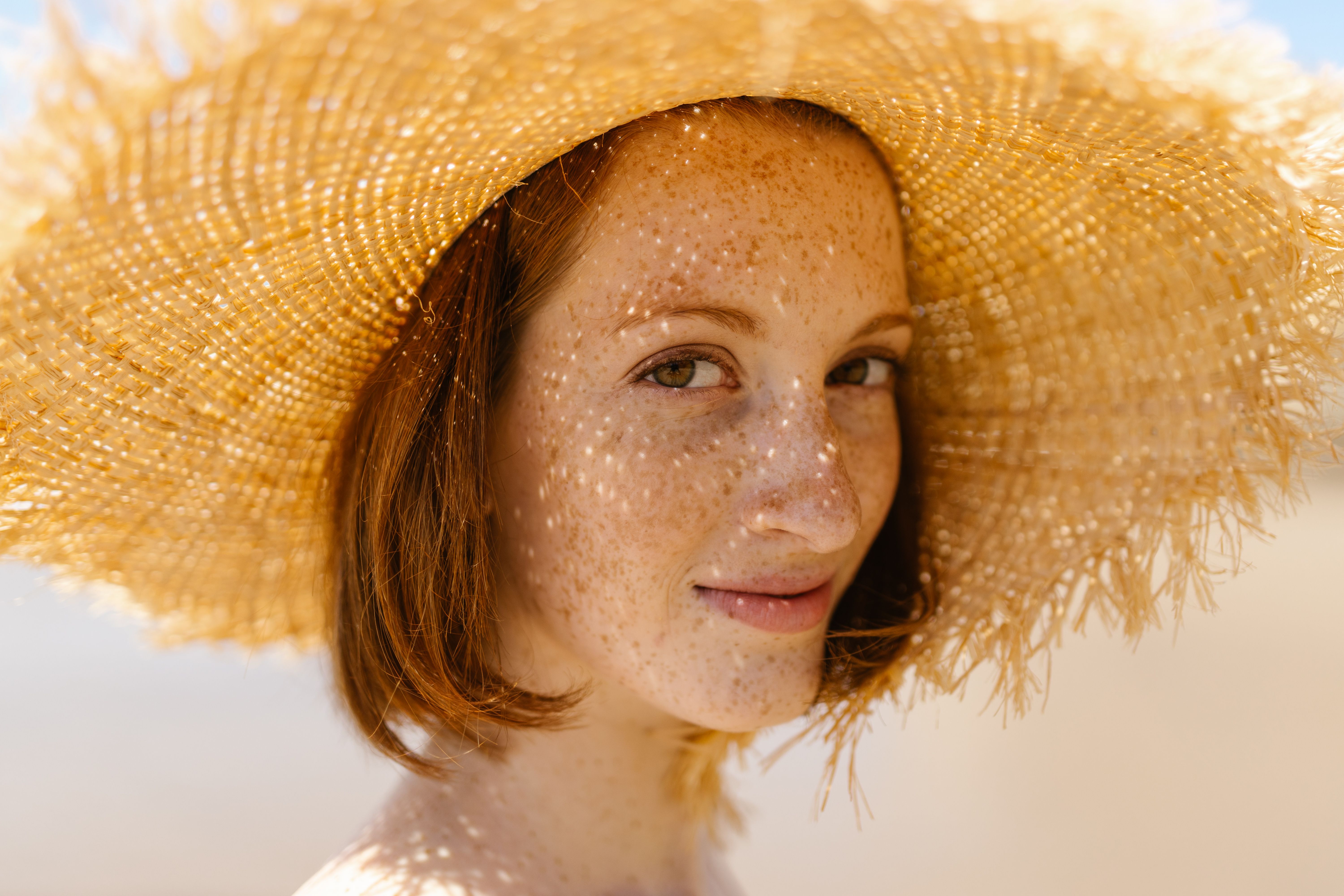 Reference photograph of facial freckles