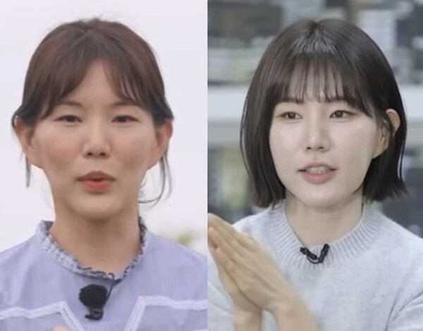 Hyun-sook chia sẻ về filler và Botox