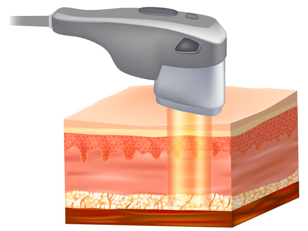 Hình ảnh trong bài viết 3